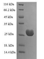 Human Uncharacterized protein KIAA1377 (KIAA1377), partial Recombinant Protein, N-His-SUMO, aa 559–670, E.coli - BioCrest Sci