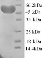 Rat Hemopexin (Hpx) Recombinant Protein, N-His, aa 24–460, Yeast - BioCrest Sci