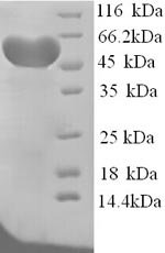 Rat Hemopexin (Hpx) Recombinant Protein, N-His, aa 24–460, Yeast, Rattus norvegicus (Rat), Yeast, N-terminal 6xHis-tagged, 50.9 kDa, purity >≥ 90% as determined by SDS-PAGE.