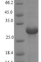 Macaca mulatta CD40 ligand (CD40LG), partial Recombinant Protein - BioCrest Sci