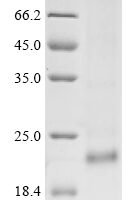 Hepatitis B virus genotype C subtype ayw Capsid protein (C) Recombinant Protein, N-10His - BioCrest Sci