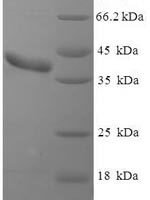 Mouse Clathrin light chain A (Clta) Recombinant Protein, N-His-SUMO - BioCrest Sci