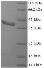 Mouse Clathrin light chain A (Clta) Recombinant Protein, N-His-SUMO, Mus musculus (Mouse), E.coli, N-terminal 6xHis-SUMO-tagged, 41.6 kDa, purity >≥ 90% as determined by SDS-PAGE.