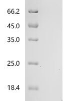 Human Pro-epidermal growth factor (EGF), partial Recombinant Protein, Tag-Free - BioCrest Sci