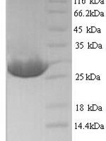 Silene chalcedonica Ribosome-inactivating protein lychnin Recombinant Protein, N-His, aa 1–234, Yeast - BioCrest Sci