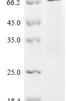 Human Prolyl endopeptidase FAP (FAP), partial Recombinant Protein, N-His - BioCrest Sci