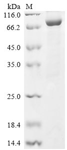 Human Prolyl endopeptidase FAP (FAP), partial Recombinant Protein, N-His, Homo sapiens (Human), E.coli, N-terminal 6xHis-tagged, 86.5 kDa, purity >≥ 85% as determined by SDS-PAGE.