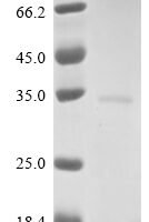 Vesicular stomatitis Indiana virus Matrix protein (M) Recombinant Protein, N-His, aa 1–237, Yeast - BioCrest Sci