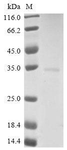 Vesicular stomatitis Indiana virus Matrix protein (M) Recombinant Protein, N-His, aa 1–237, Yeast, Vesicular stomatitis Indiana virus (strain Glasgow) (VSIV), Yeast, N-terminal 6xHis-tagged, 28.8 kDa, purity >≥ 90% as determined by SDS-PAGE.
