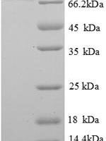 Rat Alpha-2 antiplasmin (Serpinf1) Recombinant Protein - BioCrest Sci