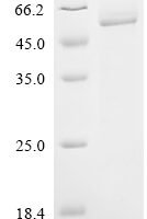 Human 1-acylglycerol-3-phosphate O-acyltransferase PNPLA3 (PNPLA3), partial Recombinant Protein - BioCrest Sci