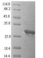 Cyprinus carpio Parvalbumin (cyp c 1.02) Recombinant Protein - BioCrest Sci