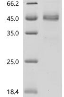 Mouse Platelet-derived growth factor subunit B (Pdgfb) Recombinant Protein - BioCrest Sci