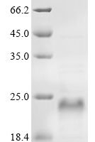 Human Nascent polypeptide-associated complex subunit alpha (NACA) Recombinant Protein - BioCrest Sci