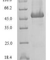 Human Sorcin (SRI) Recombinant Protein, N-GST - BioCrest Sci