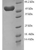 Human Plexin-A4 (PLXNA4), partial Recombinant Protein - BioCrest Sci