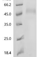 Mouse Tumor-associated calcium signal transducer 2 (Tacstd2), partial Recombinant Protein - BioCrest Sci