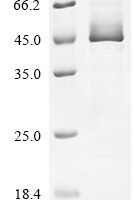 Human Serpin H1 (SERPINH1) Recombinant Protein, Tag-Free - BioCrest Sci