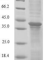 Human Glutaredoxin-2, mitochondrial (GLRX2) Recombinant Protein - BioCrest Sci