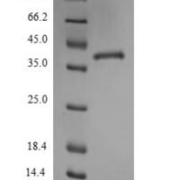 Mouse Thrombospondin-1 (Thbs1), partial Recombinant Protein - BioCrest Sci