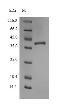 Mouse Thrombospondin-1 (Thbs1), partial Recombinant Protein, Mus musculus (Mouse), Yeast, N-terminal 6xHis-tagged, 38.6 kDa, purity >≥ 90% as determined by SDS-PAGE.