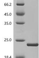 Macaca fascicularis Interleukin-1 beta (IL1B) Recombinant Protein, N-His, aa 117–268, E.coli - BioCrest Sci