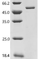 Human Protein ABHD18 (ABHD18) Recombinant Protein, C-His - BioCrest Sci