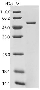 Human Protein ABHD18 (ABHD18) Recombinant Protein, C-His, E.coli, C-terminal 6xHis-tagged, 51.0 kDa, purity >≥ 85% as determined by SDS-PAGE.