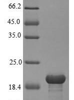 Rat Sortilin (Sort1), partial Recombinant Protein, N-His, aa 610–754, E.coli - BioCrest Sci