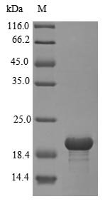 Rat Sortilin (Sort1), partial Recombinant Protein, N-His, aa 610–754, E.coli, Rattus norvegicus (Rat), E.coli, N-terminal 6xHis-tagged, 20.5 kDa, purity >≥ 90% as determined by SDS-PAGE.