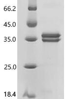 Streptococcus sp. group G Immunoglobulin G-binding protein G (spg), partial Recombinant Protein, N-His, aa 291–497, Purity ≥85%, MW 32.7 kDa - BioCrest Sci