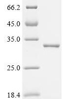 Escherichia coli ABC transporter arginine-binding protein 1 (artJ) Recombinant Protein - BioCrest Sci