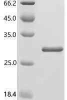 Human Histatin-1 (HTN1) Recombinant Protein, N-His-SUMO - BioCrest Sci