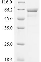 Mouse Tyrosine-protein kinase Srms (Srms) Recombinant Protein - BioCrest Sci