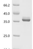 Human Pro-epidermal growth factor (EGF), partial Recombinant Protein, C-hFc1 - BioCrest Sci