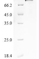 Human Protein mono-ADP-ribosyltransferase TIPARP (TIPARP) Recombinant Protein, N-His - BioCrest Sci