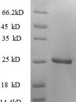 Human Tumor necrosis factor ligand superfamily member 9 protein (TNFSF9), partial Recombinant Protein - BioCrest Sci