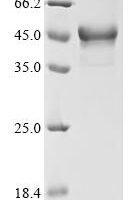 Human Protein fosB (FOSB) Recombinant Protein - BioCrest Sci