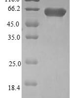 Human Pleckstrin homology domain-containing family F member 2 (PLEKHF2) Recombinant Protein - BioCrest Sci