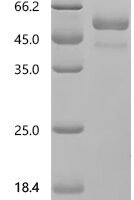 Human Sodium/potassium-transporting ATPase subunit alpha-2 (ATP1A2), partial Recombinant Protein, C-10His - BioCrest Sci