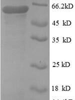 Human Protein disulfide-isomerase (P4HB), partial Recombinant Protein, N-GST - BioCrest Sci