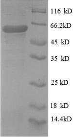 Human Protein disulfide-isomerase (P4HB), partial Recombinant Protein, N-GST, Homo sapiens (Human), E.coli, N-terminal GST-tagged, 58.7 kDa, purity >≥ 90% as determined by SDS-PAGE.