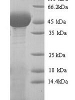 Chamaecyparis obtusa Pectate lyase 1 Recombinant Protein - BioCrest Sci