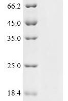 Rabbit B (0,+)-type amino acid transporter 1 (SLC7A9), partial Recombinant Protein - BioCrest Sci