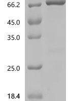 Human GTPase HRas (HRAS), partial, Biotinylated Recombinant Protein - BioCrest Sci