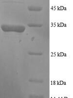 Human Growth arrest and DNA damage-inducible protein GADD45 alpha (GADD45A) Recombinant Protein - BioCrest Sci