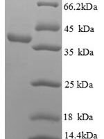 Human DNA repair nuclease/redox regulator APEX1 (APEX1) Recombinant Protein, N-His, aa 32–318, E.coli - BioCrest Sci