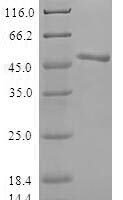 Human ADP-ribosylation factor 3 (ARF3) Recombinant Protein - BioCrest Sci