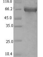 Human Long-chain-fatty-acid--CoA ligase 5 (ACSL5), partial Recombinant Protein - BioCrest Sci