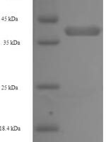 Human Napsin-A (NAPSA) Recombinant Protein - BioCrest Sci